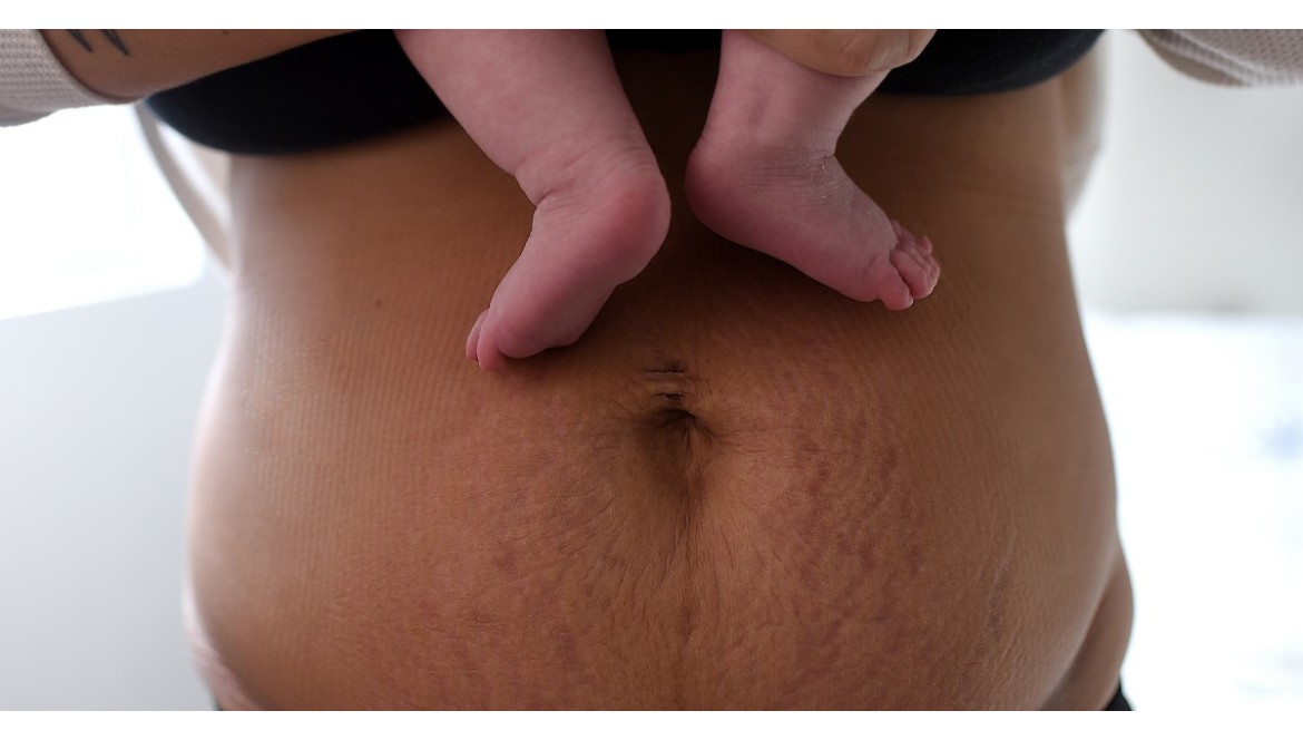 Pasy brzuszne po porodzie: wsparcie dla świeżo upieczonych mam